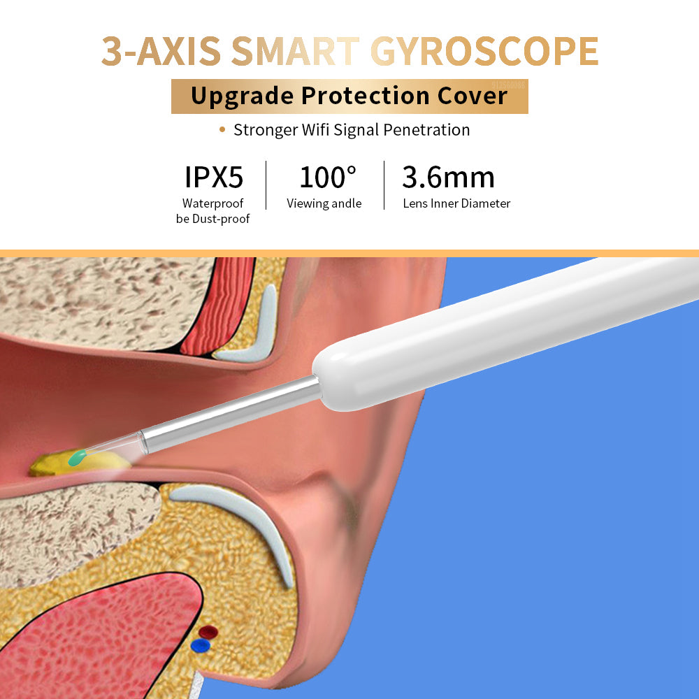 Limpiador de oídos NE3, otoscopio, herramienta de eliminación de cera de los oídos con cámara, luz LED, endoscopio de oído inalámbrico, Kit de limpieza de orejas para I-phone