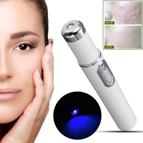 Caneta laser para terapia de luz azul, dispositivo de tratamento para remoção de rugas e cicatrizes macias, equipamento de beleza para cuidados com a pele